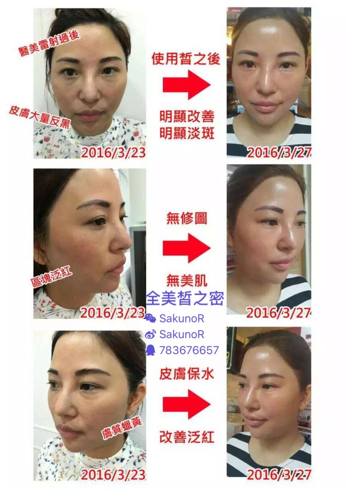 关于皙之密的这些,那些问题…(传销?副作用?效