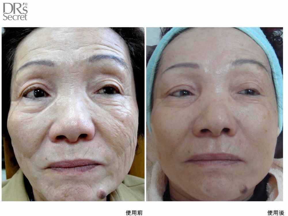 关于皙之密的这些,那些问题…(传销?副作用?效