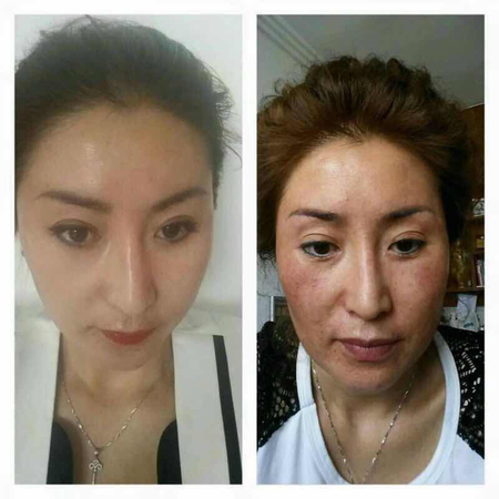 关于皙之密的这些,那些问题…(传销?副作用?效