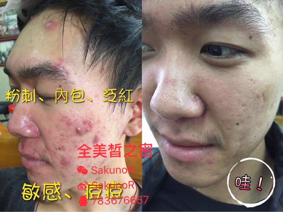 关于皙之密的这些,那些问题…(传销?副作用?效